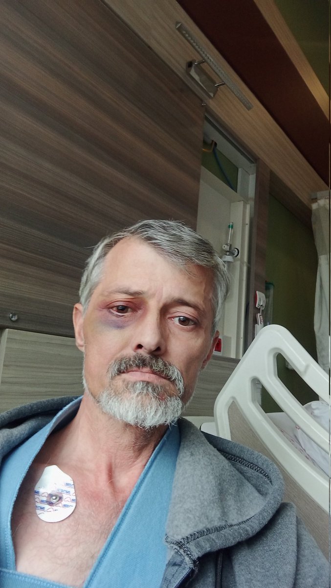 Selam <a href="/isikhanvedat/">Prof. Dr. Vedat Işıkhan</a>  <a href="/Akparti/">AK Parti</a> <a href="/MhpTbmmGrubu/">MHP TBMM Grubu #MHP</a>  Gebze şehir Hastanesi'nde beyincerrhisi bölüm 1 yılla emekli edilmedim adalet nerede kim iş verir bana <a href="/mihribanugurluu/">Mihriban UĞURLU ⚖️</a> <a href="/aykutugurlu/">Aykut⚖️</a> @2000LereADALET <a href="/adilemeklilik/">Emeklilikte Kademeli Yaş Düzenlemesi</a>