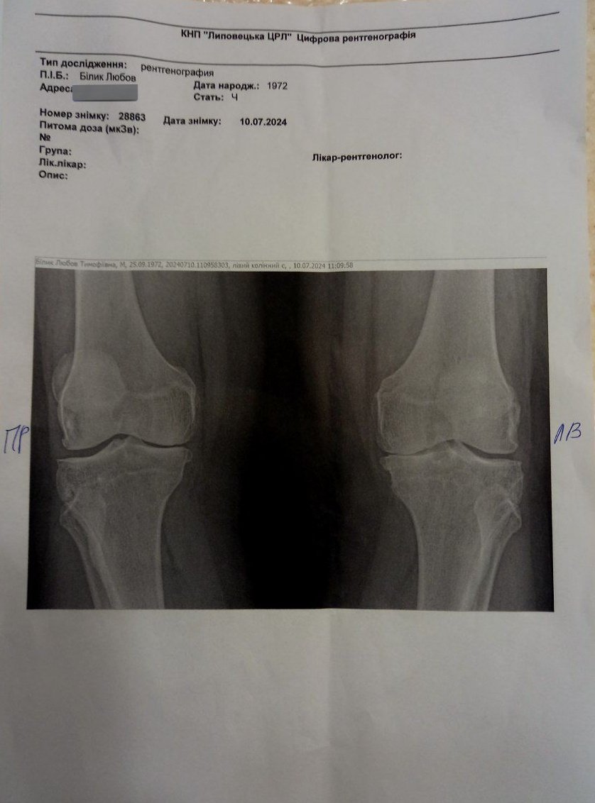 Збір на операцію для мами по ендопротезуванню колінних суглобів. Прикріпляю фото лікарського заключення та рентген-знімки. 
Посилання на банку: send.monobank.ua/jar/3Gut8Y14wM

М'ю прошу поширити❤