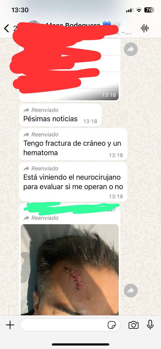 GuilleValdez8's tweet photo. @hebesil Ningún violento el que sufrió esto un hincha que es socio, son lo más asqueroso que hay https://t.co/vvu3n8ieF5