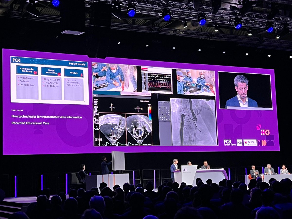 Julio Echarte (@jcecharte) on Twitter photo New technologies for transcatheter interventions🌟<a href="/azeemlatib/">Azeem Latib</a> <a href="/nickaram/">Nicole Karam, MD, PhD, FESC</a>
🎯65 y/o with severe MR
✅ TMVR with Intrepid <a href="/nicolo_piazza/">Nicolo Piazza</a>
🎯75 y/o with severe TR
✅ TTVR with Lux-Valve <a href="/RodrigoEstvez1/">Rodrigo Estévez</a>
🎯64 y/o and severe AS
✅ FIH TAVR with <a href="/AbbottCardio/">Abbott Cardiovascular</a> <a href="/bapat_savrtavr/">vinayak bapat</a> New technologies for transcatheter interventions🌟<a href="/azeemlatib/">Azeem Latib</a> <a href="/nickaram/">Nicole Karam, MD, PhD, FESC</a>
🎯65 y/o with severe MR
✅ TMVR with Intrepid <a href="/nicolo_piazza/">Nicolo Piazza</a>
🎯75 y/o with severe TR
✅ TTVR with Lux-Valve <a href="/RodrigoEstvez1/">Rodrigo Estévez</a>
🎯64 y/o and severe AS
✅ FIH TAVR with <a href="/AbbottCardio/">Abbott Cardiovascular</a> <a href="/bapat_savrtavr/">vinayak bapat</a>