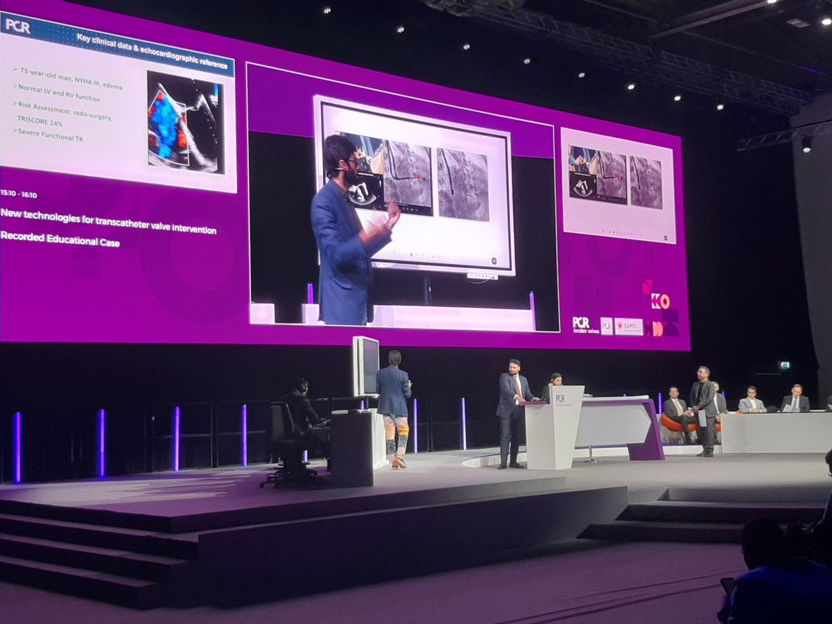 Manuel Barreiro-Perez (@manuelbarreirop) on Twitter photo We are really honored and proud by the opportunity to share our experience in the main arena <a href="/PCRonline/">PCRonline 🫀</a> #PCRLV. A lot of innovation (Cardiovalve, Dragonfly, LuxPlus, x11 3D-miniTEE, CT-fusion) thanks to the effort of the amazing team behinds <a href="/Hosp_ACunqueiro/">H.ÁlvaroCunqueiro</a> <a href="/cardiochuvi/">cardiochuvi</a> We are really honored and proud by the opportunity to share our experience in the main arena <a href="/PCRonline/">PCRonline 🫀</a> #PCRLV. A lot of innovation (Cardiovalve, Dragonfly, LuxPlus, x11 3D-miniTEE, CT-fusion) thanks to the effort of the amazing team behinds <a href="/Hosp_ACunqueiro/">H.ÁlvaroCunqueiro</a> <a href="/cardiochuvi/">cardiochuvi</a>