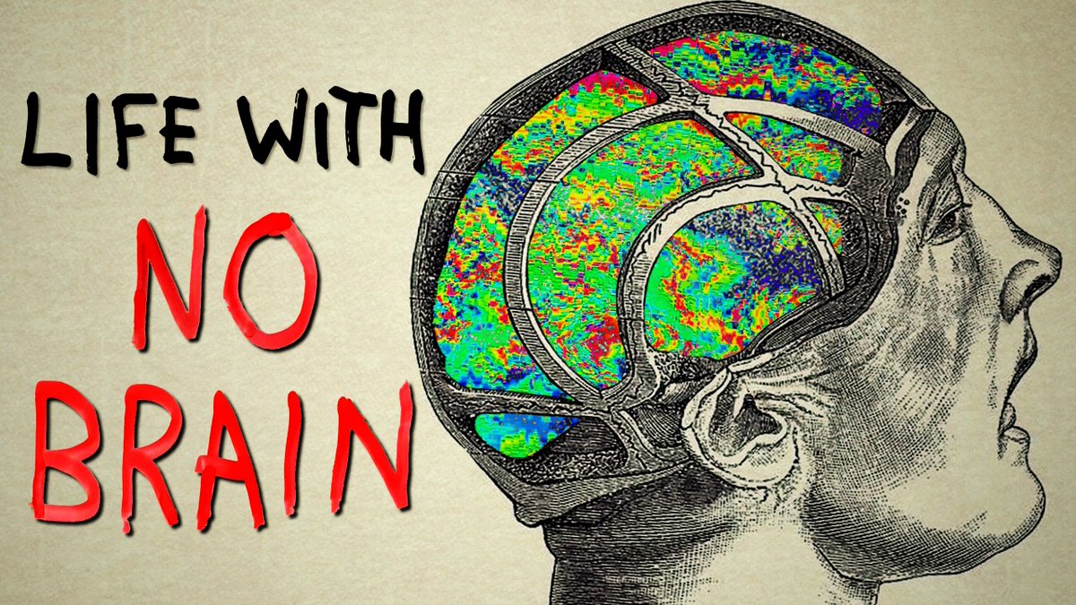 The Man Who Lived with No Brain

[new video] --&gt; youtu.be/nCWuPMUPyRk