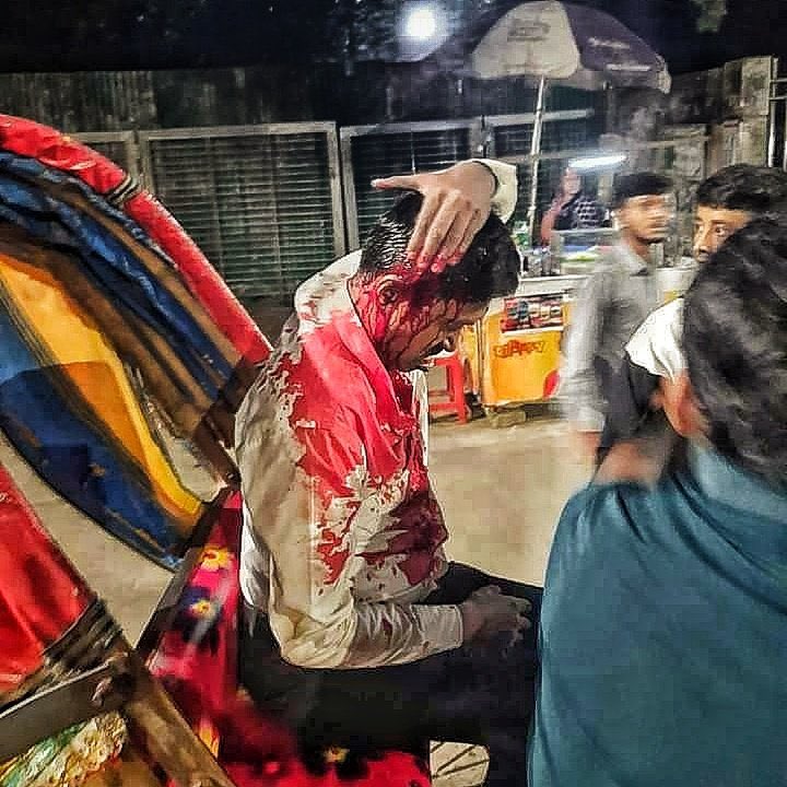 saddamhussainbd's tweet photo. The arrest of Sri Chinmoy Krishna Das, a respected @IskconInc leader and vocal advocate for minority rights in #Bangladesh, is widely seen as a blatant attempt to suppress voices defending the country’s #Hindu community. This has ignited nationwide protests.

Peaceful demonstrations in #Shahbagh were met with violence, as attackers, mainly the supporters of @Yunus_Centre and @bdbnp78 targeted unarmed Hindu protesters, leaving many injured- while police reportedly stood by. Protests in Chittagong, Cox’s Bazar, and Maulvi Bazar also faced similar disruptions, raising fears of organized repression against minorities.

The arrest and ensuing violence have heightened concerns about the state of #minority rights in Bangladesh. The country appears to be sliding toward systematic persecution of religious minorities, with an unconstitutional, #radical regime driving it toward becoming an anti-minority state.

The international community is urged to act swiftly, holding the illegal government accountable for its violation of human rights and religious freedom. Delayed action risks emboldening further violations against minorities.

#FreeChinmoyKrishnaDas #ProtectHinduMinorities #EndReligiousPersecution
#SaveBangladeshiHindus

@albd1971 @sajeebwazed @MAarafat71 @TulsiGabbard @MEAIndia @ihcdhaka @BDMOFA @volker_turk @UN_HRC @hrw @nytimes @TIME @firstpost @TheEconomist @bbcbangla  @SushantaDGupta @ATeam_1971 @TimesAlgebraIND @WIONews @Chellaney @timesofindia @JonFDanilowicz @IndiaToday @AadiAchint @hindupost @ThePrintIndia @EconomicTimes   @ndtvindia @BangladeshThree @ChiefAdviserGoB @bdwatch2024 @HinduVoice @bdperspectives