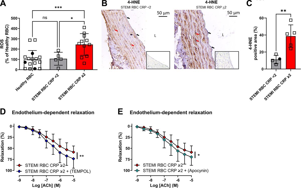 Study published in Call for Papers on #Inflammation &amp; CV Disease suggests that red blood cells deserve attention as a key player in systemic inflammation and STEMI. ow.ly/7kFi50UfiE7