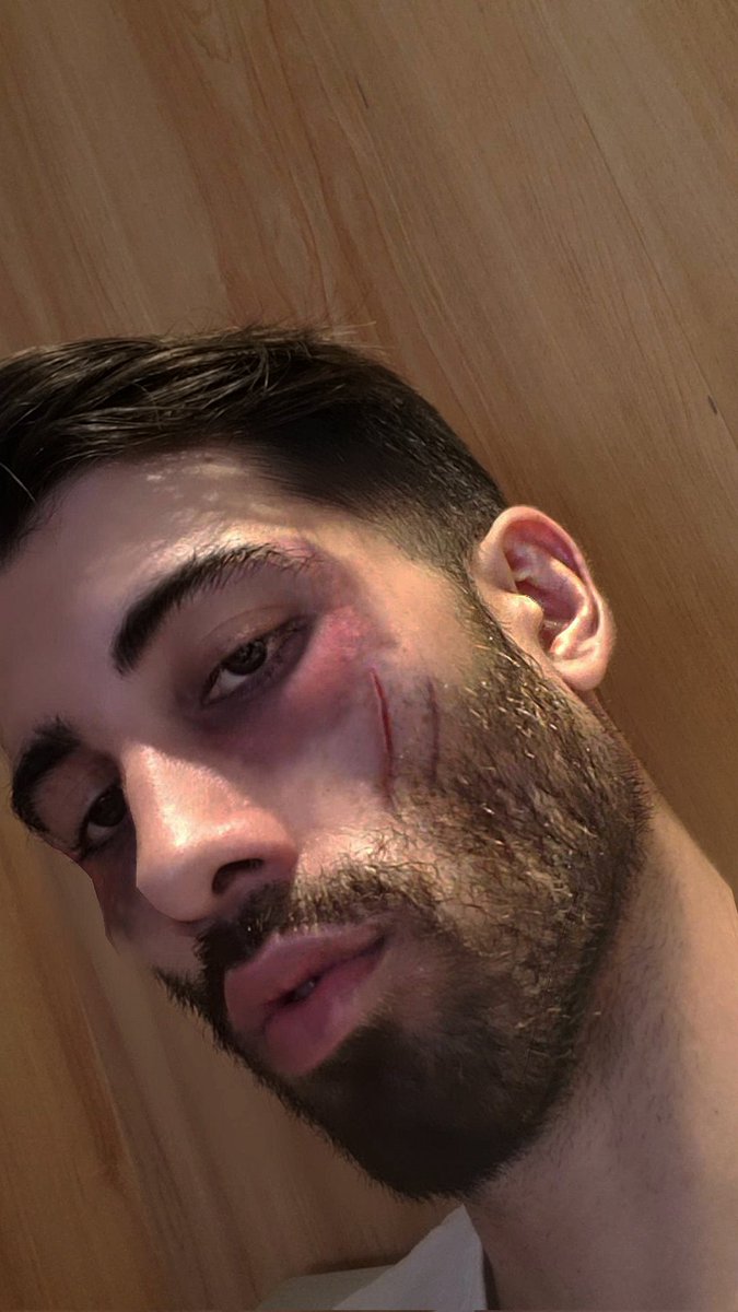 protiveboy's tweet image. Hard