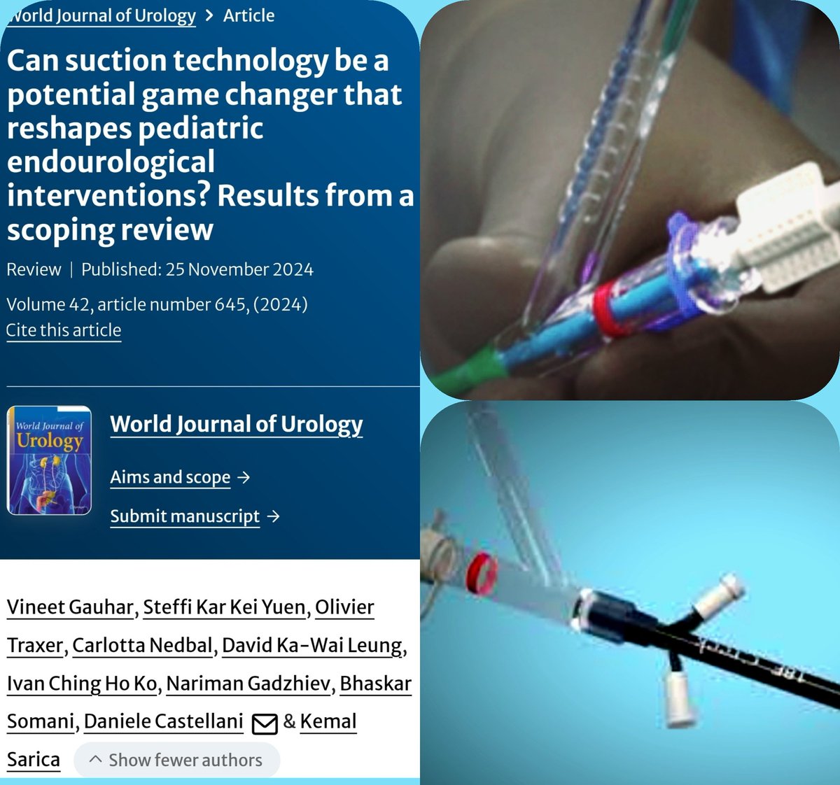DrG (@docgauhar) on Twitter photo 🔥➡️ <a href="/wjurol/">World Journal of Urology</a>
#suction #Pediatrics #minipcnl #Rirs <a href="/drkemalsarica/">Kemal Sarıca</a> <a href="/endouro/">Prof Bhaskar Somani</a> <a href="/OTRAXER/">Olivier Traxer</a> <a href="/steffiyuen/">Steffi Yuen</a> <a href="/Urologeman/">Urologeman (Nariman Gadzhiev)</a> <a href="/CarlottaNedbal/">Carlotta Nedbal</a> <a href="/CUHKofficial/">The Chinese University of Hong Kong - CUHK</a> <a href="/YPedUrolClub/">Young Pediatric Urologists Club</a> <a href="/PEARLSendouro/">PEARLS</a> <a href="/SectionOnPedUro/">Section on Pediatric Urology</a> <a href="/ESPUorg/">ESPU</a> <a href="/Peds_Urology/">PediatricUrologyAssociates</a> <a href="/DukePedsUro/">Duke Pediatric Urology</a> @VUMCPedsUrology
<a href="/SpringerUrology/">Springer Urology</a>
doi.org/10.1007/s00345… 🔥➡️ <a href="/wjurol/">World Journal of Urology</a>
#suction #Pediatrics #minipcnl #Rirs <a href="/drkemalsarica/">Kemal Sarıca</a> <a href="/endouro/">Prof Bhaskar Somani</a> <a href="/OTRAXER/">Olivier Traxer</a> <a href="/steffiyuen/">Steffi Yuen</a> <a href="/Urologeman/">Urologeman (Nariman Gadzhiev)</a> <a href="/CarlottaNedbal/">Carlotta Nedbal</a> <a href="/CUHKofficial/">The Chinese University of Hong Kong - CUHK</a> <a href="/YPedUrolClub/">Young Pediatric Urologists Club</a> <a href="/PEARLSendouro/">PEARLS</a> <a href="/SectionOnPedUro/">Section on Pediatric Urology</a> <a href="/ESPUorg/">ESPU</a> <a href="/Peds_Urology/">PediatricUrologyAssociates</a> <a href="/DukePedsUro/">Duke Pediatric Urology</a> @VUMCPedsUrology
<a href="/SpringerUrology/">Springer Urology</a>
doi.org/10.1007/s00345…