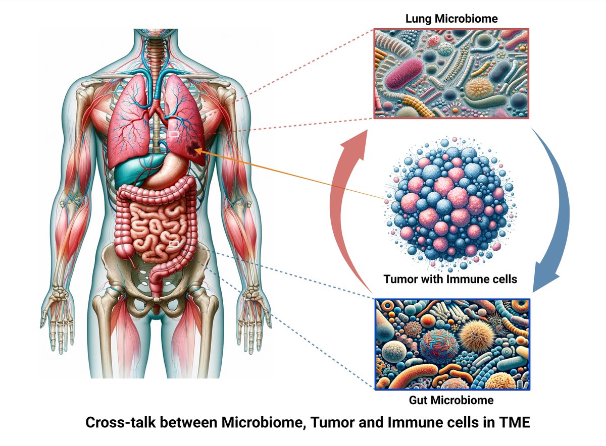 Keshav Raj Paudel (@drkeshavrajpau1) on Twitter photo Review article: Gut and lung dysbiosis on lung cancer progression <a href="/MedComm_MC/">MedComm</a>
<a href="/ON77034582/">राजON💊</a> <a href="/drjesusshrestha/">Jesus Shrestha</a> <a href="/SobiaIdrees11/">Sobia Idrees</a> <a href="/Tayyabasadaf90/">Tayyaba sadaf</a> <a href="/PanthNisha/">Nisha Panth</a> <a href="/gauravpharma25/">Gaurav Gupta</a> <a href="/SachinK00306908/">Sachin Kumar Singh</a> <a href="/Kam_Dua/">Kamal Dua</a> <a href="/SatishRojekar/">Satish Rojekar</a> <a href="/HansbroResearch/">Hansbro Research</a> <a href="/CentenaryInst/">Centenary Institute</a> <a href="/UTS_Science/">UTS Science</a>
onlinelibrary.wiley.com/doi/full/10.10… Review article: Gut and lung dysbiosis on lung cancer progression <a href="/MedComm_MC/">MedComm</a>
<a href="/ON77034582/">राजON💊</a> <a href="/drjesusshrestha/">Jesus Shrestha</a> <a href="/SobiaIdrees11/">Sobia Idrees</a> <a href="/Tayyabasadaf90/">Tayyaba sadaf</a> <a href="/PanthNisha/">Nisha Panth</a> <a href="/gauravpharma25/">Gaurav Gupta</a> <a href="/SachinK00306908/">Sachin Kumar Singh</a> <a href="/Kam_Dua/">Kamal Dua</a> <a href="/SatishRojekar/">Satish Rojekar</a> <a href="/HansbroResearch/">Hansbro Research</a> <a href="/CentenaryInst/">Centenary Institute</a> <a href="/UTS_Science/">UTS Science</a>
onlinelibrary.wiley.com/doi/full/10.10…