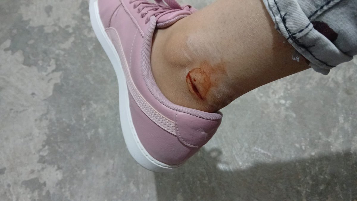 Huba_Mich's tweet photo. @municipio_leon 

Tenemos un perro agresivo que se ha reportado desde el 7 de sep con folio 476237

¿qué tan urgente es para que atiendan? 
Ya mordió ya a una señora dejándole una herida que tubo se que saturada.  
@AleGutierrez_mx https://t.co/ccfsFXoGMx