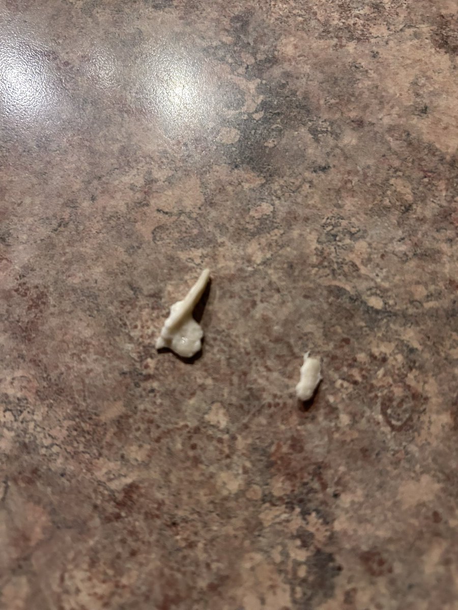 Wow found plastic in Liberte Greek Yogurt! Bought at Loblaws Kingston! Contacted Loblaws and Liberte and no response! Their lack of customer service is poor but their concern for customer safety is worse! #yogurt <a href="/loblawco/">Loblaw Companies</a>