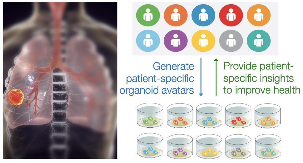 Roose Lab UCSF (@roose_jeroen) on Twitter photo “Will this therapy work for my cancer?” is the question that every cancer patient will ask. Thank you to the Marcus Program in <a href="/UCSFPrecision/">UCSF Precision Medicine</a> <a href="/UCSF/">UC San Francisco</a> <a href="/ucsfhealth/">UCSF Health</a> that supported our early patient organoid work: precisionmedicine.ucsf.edu/news/evolution…. DM if you want to collaborate. “Will this therapy work for my cancer?” is the question that every cancer patient will ask. Thank you to the Marcus Program in <a href="/UCSFPrecision/">UCSF Precision Medicine</a> <a href="/UCSF/">UC San Francisco</a> <a href="/ucsfhealth/">UCSF Health</a> that supported our early patient organoid work: precisionmedicine.ucsf.edu/news/evolution…. DM if you want to collaborate.