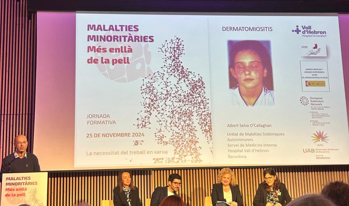 U. M. Sistèmiques. Medicina Interna H. V. d'Hebron (@mivhsistemiques) on Twitter photo El Dr Selva de <a href="/MIVHSistemiques/">U. M. Sistèmiques. Medicina Interna H. V. d'Hebron</a> participa en la jornada formativa ‘MALALTIES MINORITÀRIES Més enllà de la pell’ 👇mostrando aspectos de la Dermatomiositis.
<a href="/vallhebron/">Vall d'Hebron</a> <a href="/dmpacients/">Grup de Pacients de #Dermatomiositis · BCN</a> El Dr Selva de <a href="/MIVHSistemiques/">U. M. Sistèmiques. Medicina Interna H. V. d'Hebron</a> participa en la jornada formativa ‘MALALTIES MINORITÀRIES Més enllà de la pell’ 👇mostrando aspectos de la Dermatomiositis.
<a href="/vallhebron/">Vall d'Hebron</a> <a href="/dmpacients/">Grup de Pacients de #Dermatomiositis · BCN</a>