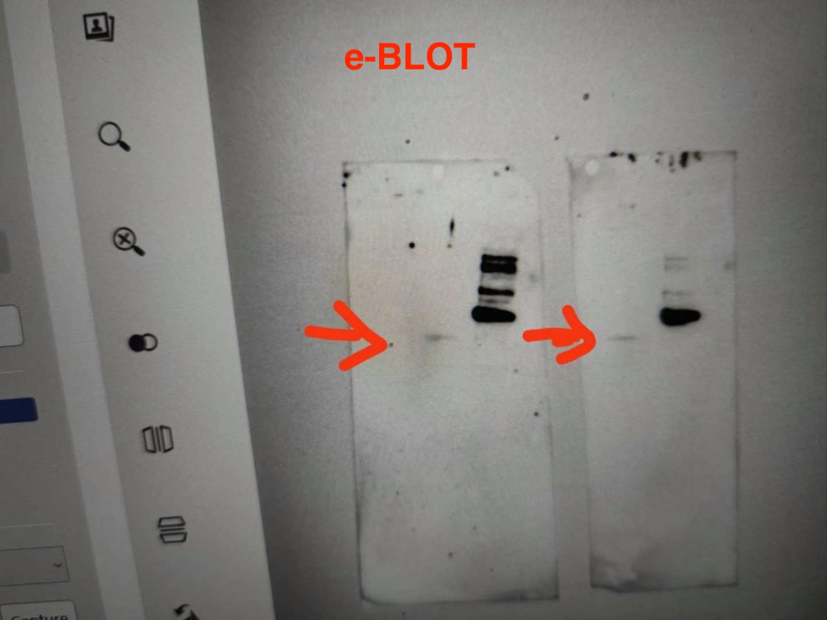 Thanks to e-BLOT, researchers at Wageningen University's Plant Breeding Department successfully detected a western blot band that had remained elusive for a year. Attached are photos comparing their previous system with e-BLOT's improved results.