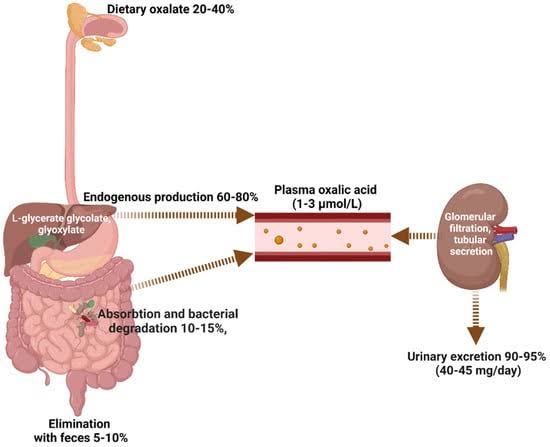 EEzhilME's tweet photo. @JasmineNephro Acute oxalate nephropathy (AON) induced by high dietary intake of oxalate-rich food is a rare cause of acute kidney injury and end-stage renal disease (ESRD). We describe a 68-year-old man with adequate baseline renal function who developed severe AON and ESRD https://t.co/dbiqPq8MKU