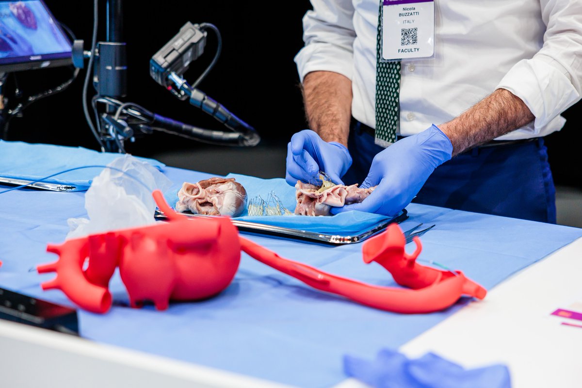 PCRonline's tweet photo. Hey there #cardiotwitter, it's Day 3⃣ of PCR London Valves #PCRLV 🇬🇧 2024!
On the menu today;
🏥 2 LIVE Educational cases: #TAVI durability and tricuspid #TEER
🫀 Cases and Complications
⚡️Electrosurgery and leaflet modification #PartnersinLearning with @crfheart
🥇 #EAPCI Awards Ceremony
👋 Closing Ceremony
And so much more.
We hope you fully enjoy this last day of learning & sharing, and remember: keep on tweeting 😉
#TAVI #TAVR #TMVR #TreatTR #FixTR #interventionalcardiology #CardioEd
@PamelaGatto @TagliariPaula @dr_serkanasil @guilbon @MiChen__ @CurioJonathan @fiona_fionak1 @denisamuraru @dr_tyxiong @ABeneduceMD @Dr_Harriet @cvnurselin @MarciMonteg @EZancanaroMD