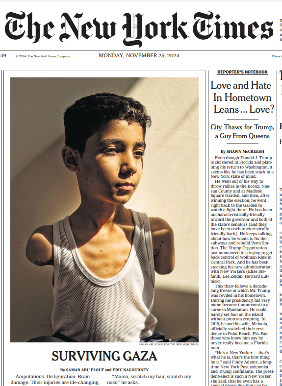 This child is not surviving Gaza. He is surviving Zionism and the murder machine of Western colonialism. He is surviving a culture of callous murder and mass murder, dehumanization, theft, exploitation, and profit for Western corporations.

He is surviving the Judeo-Christian