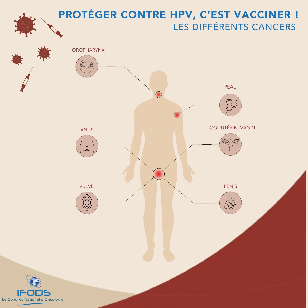 HPV, c'est toute l'année ! 🎗️

Les infections à #papillomavirushumains (HPV) sont courantes et hautement contagieuses : entre 70 et 80 % de la population sera exposée aux #HPV au cours de sa vie.