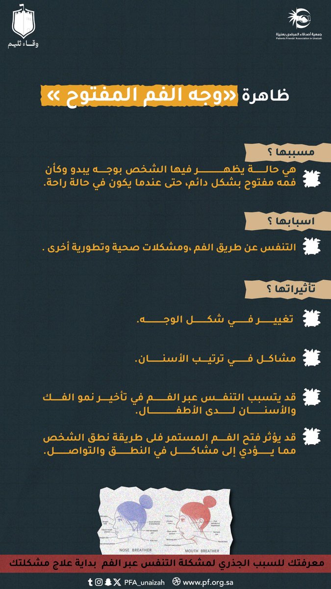pfa_unaizah's tweet photo. تتنفس عن طريق الفم ؟ 

انتبه 🚨

عالج سبب المشكلة قبل أن تُؤثر على شكل الوجه والأسنان والنطق لديك 📢

#سنة_عجاجان
#وقاء_ثليم https://t.co/gKfIiJsKPy