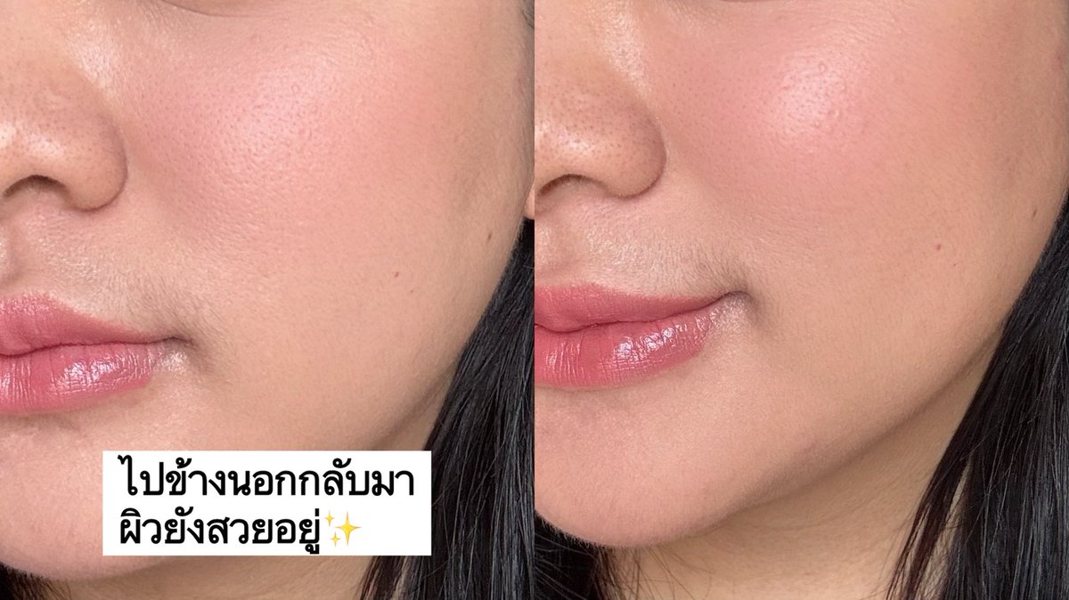 lisabubblegummy's tweet photo. #SRICHAND ออกแป้งผสมรองพื้นคุมมันตัวใหม่ #SUPERFIX  คุมมันนาน 18 ชม.

เนื้อแป้งละเอียด ไม่หนักไม่หนา เราทากันแดดแล้วลงแป้งศรีจันทร์ทับ เบลอผิวสวย ฟินิชจะเป็นแมตต์กำลังดี ปกปิดปานกลาง ใช้พัฟบิ้วเพิ่มได้ รุ่นนี้กันน้ำกันเหงื่อติดทนสุดๆ

เราไปข้างนอกนั่งวินโดนแดดเหงื่อออกกลับมา เมคอัพยังสวยอยู่เลย ไม่เป็นคราบ เราใช้สี N10 น้า

 #แป้งฟิกซ์ผิว