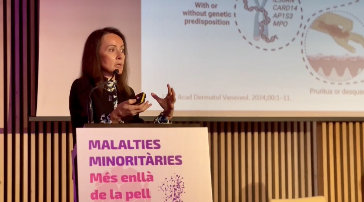 Dra Anna López de #Dermatología del ⁦<a href="/HospitalSantPau/">Sant Pau - Campus Salut Barcelona</a> en su intervención sobre la #psoriasispustulosa : “Un retraso en lel #diagnóstico,  es un retraso en el tratamiento y por tanto un empeoramiento en la calidad de vida del paciente”

#MásAlláDeLaPiel ⁦⁦<a href="/Boehringer/">Boehringer Ingelheim</a>⁩