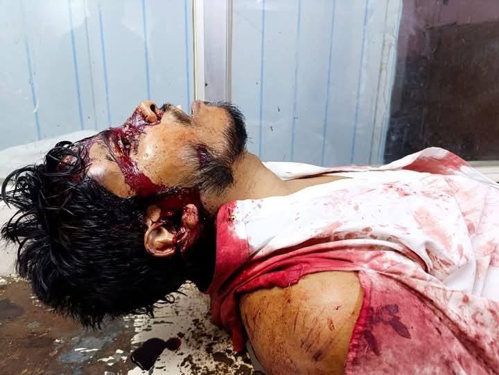 উগ্রবাদী হিন্দু সম্প্রদায়ের আক্রমণে নিহত 
সাইফুল ইসলাম আলিফ 
#SaifulIslamAlif