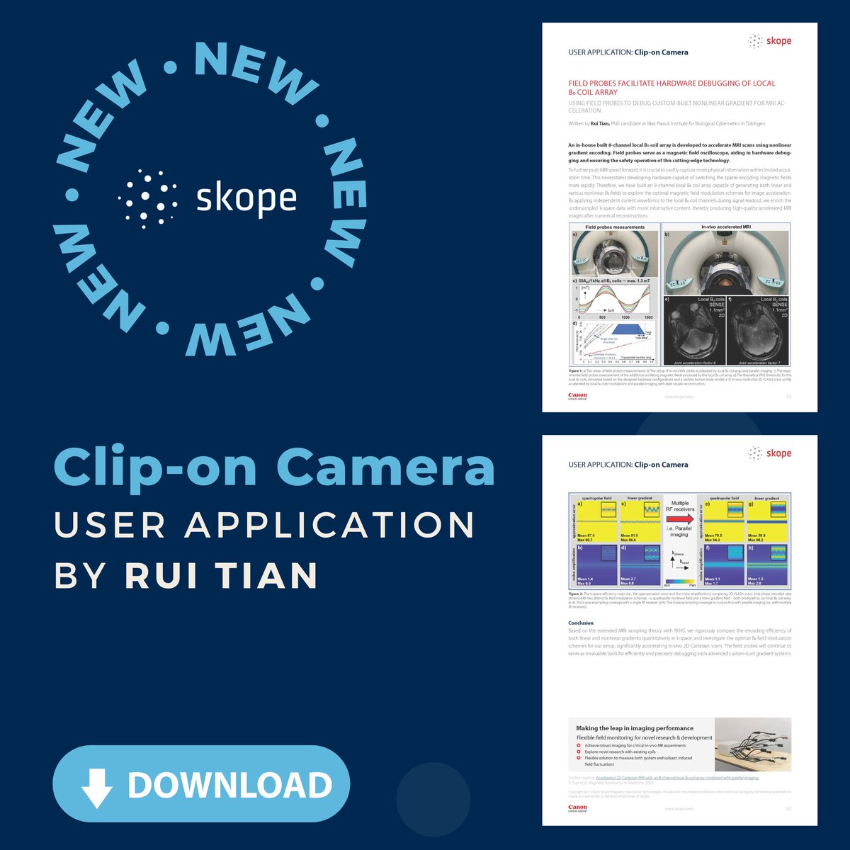 Skope (@skope_mri) on Twitter photo Download the new application note, which explores the use of field probes for debugging custom-built nonlinear gradients for #MRI acceleration. This note was authored by Rui Tian from <a href="/MPICybernetics/">Max Planck Institute for Biological Cybernetics</a>. skope.swiss/user_applicati… Download the new application note, which explores the use of field probes for debugging custom-built nonlinear gradients for #MRI acceleration. This note was authored by Rui Tian from <a href="/MPICybernetics/">Max Planck Institute for Biological Cybernetics</a>. skope.swiss/user_applicati…