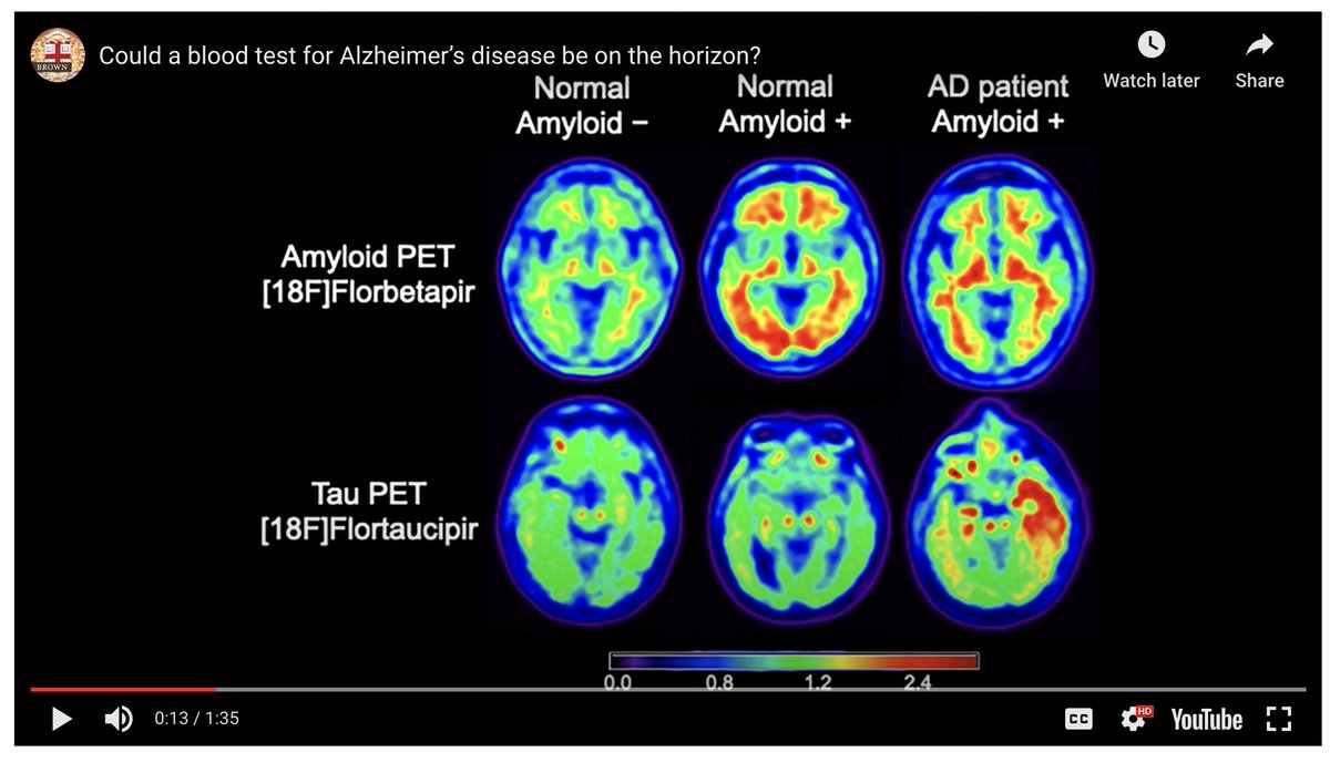 Thanks to the <a href="/OhLabBrown/">Oh Lab @ Brown</a> members who helped with this videotaping.