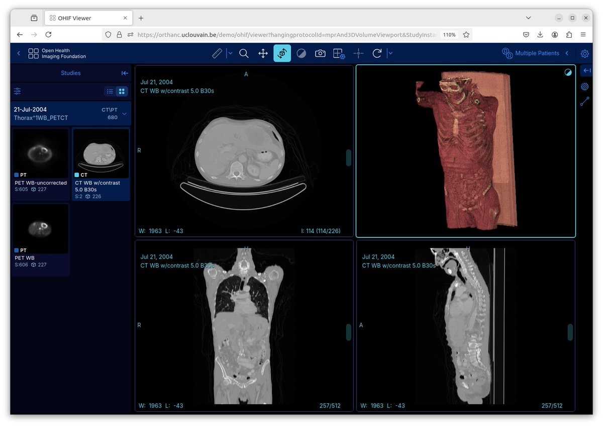 A new release of the OHIF plugin for Orthanc has just been released, featuring OHIF 3.9.1. #DICOM