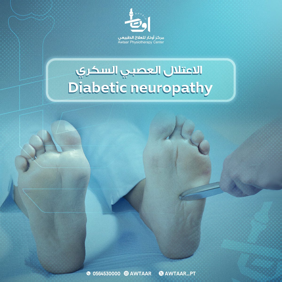 Awtaar_pt's tweet photo. ✅هو أحد أنواع تلف الأعصاب، ويُمكن أن يُصاحب داء السكري.
✅ وقد يؤدي ارتفاع مستوى سكر الدم (الغلوكوز) إلى تلف الأعصاب في مختلف أعضاء الجسم. 
✅غالبًا ما يتسبب الاعتلال العصبي السكري في تلف أعصاب الساقين والقدمين

📌للحجز والاستفسار برجاء التواصل على 
📞0564530000

#علاج_طبيعي https://t.co/FyPiWq8oYa