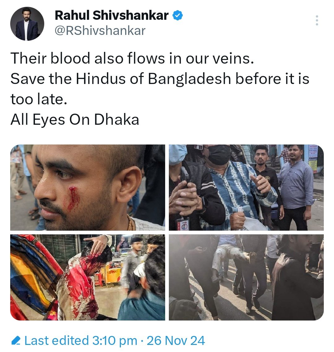AminaaKausar's tweet photo. Propaganda           |        Reality https://t.co/bN4AGD5hCV