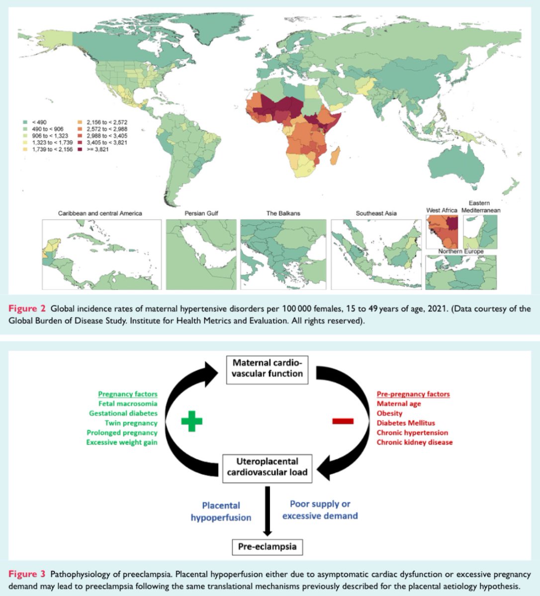 #Hypertensive #pregnancy disorder, an under-recognized women specific risk factor for #HeartFailure?

<a href="/ESC_Journals/">European Society of Cardiology Journals</a> <a href="/HanCardiomd/">Henry Han</a> <a href="/AmrAbdin10/">Amr Abdin</a> <a href="/GiuseppeGalati_/">Giuseppe Galati</a> 
📝👇🏻
onlinelibrary.wiley.com/doi/full/10.10…