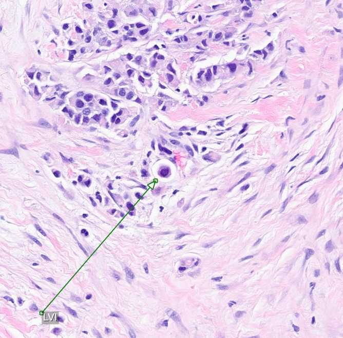CakePath's tweet photo. Eyeballing is so last century.
Sometimes, in certain places, I too live in fear that digital will never make it there.
#pathology #pathologists #PathTwitter #PathX #pathresidents #pathfellow #MedTwitter https://t.co/nPUBYCA5k0