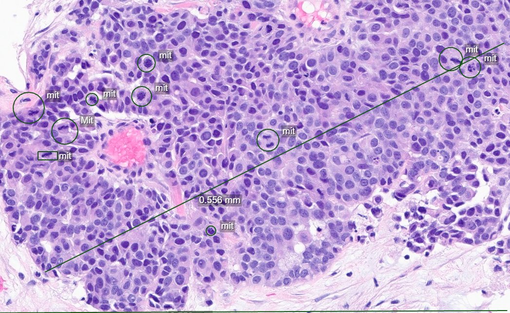 CakePath's tweet photo. Eyeballing is so last century.
Sometimes, in certain places, I too live in fear that digital will never make it there.
#pathology #pathologists #PathTwitter #PathX #pathresidents #pathfellow #MedTwitter https://t.co/nPUBYCA5k0