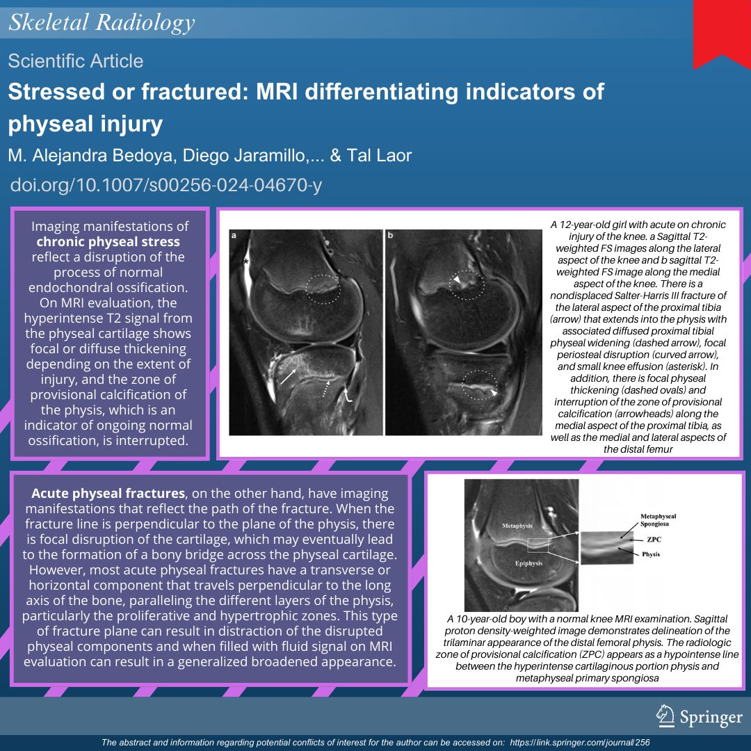 🔴 Stressed or fractured: MRI differentiating indicators of physeal injury  

Dive into this new infographic and find out more about these injuries at 👉 buff.ly/3CM53jM 

#SkeletalRadiology #pediatrics #radiology #orthopedics #radres #trauma