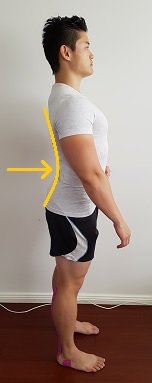 ehsanarj1's tweet image. گودی کمر یکی از عوامل شایع #کمردرد است. برای تشخیص آن به دیوار تکیه دهید. پاشنه، باسن، شانه و سر خود را به دیوار بچسبانید. دست خود را پشت کمر ببرید. اگر دست آزادانه حرکت می‌کند، گوی کمر شما زیاد است. تمرینات تقویتی عضلات کمر عوارض این اختلال را کاهش می‌دهد.
از #درد بدور باشید!