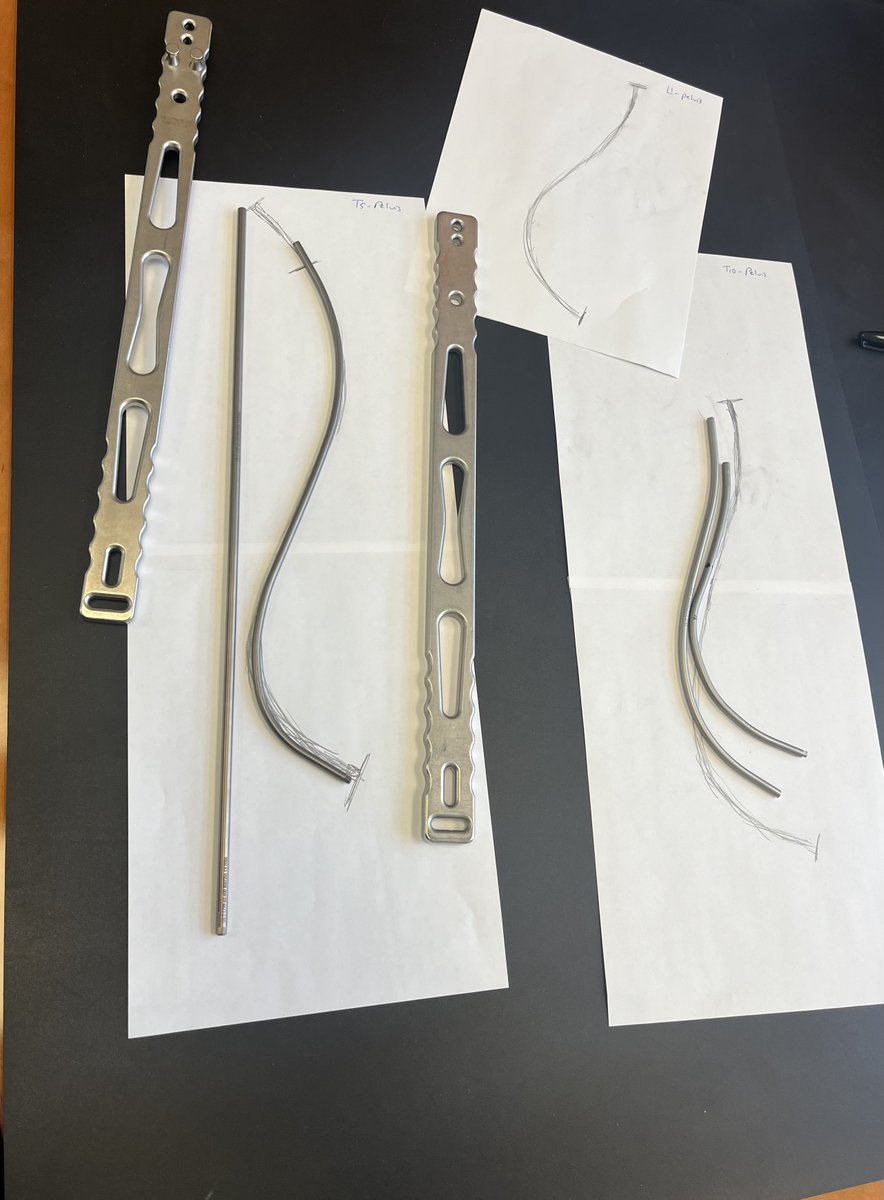 Mohamed Zaazoue (@zaazoue) on Twitter photo Spine surgery is truly an apprenticeship, where you spend years perfecting your skills and learning from masters of the field, ones like Dr. Munish Gupta (<a href="/mgspine/">Munish Gupta M.D.</a>). From "Rod Bending School" with Dr. G. Time to carry this message forward and train future surgeons! #Spine Spine surgery is truly an apprenticeship, where you spend years perfecting your skills and learning from masters of the field, ones like Dr. Munish Gupta (<a href="/mgspine/">Munish Gupta M.D.</a>). From "Rod Bending School" with Dr. G. Time to carry this message forward and train future surgeons! #Spine
