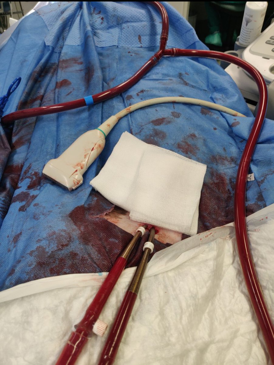 Entrenamiento multidisciplinar #ECLS con modelo animal. Canulación, cambio de configuración, complicaciones, comunicación, liderazgo. 
La calidad asistencial depende del nivel del #ECMO team.
Gracias equipo ESU <a href="/VHIR_/">Vall d'Hebron Institut de Recerca</a> 
Nuestro programa: vhc.cat/ecmo