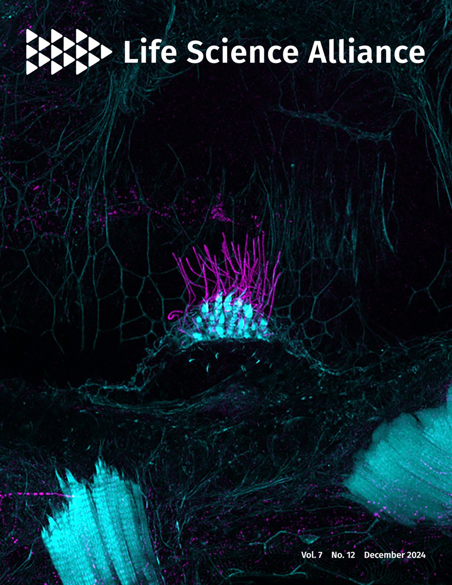 Gaurav Varshney (@varshneylab) on Twitter photo Our paper on Naa80, essential for actin N-terminal acetylation and normal hearing in zebrafish, has been selected as a cover article! life-science-alliance.org/content/7/12/e… @NAT_machinery <a href="/ShengJiaLin9413/">Sheng-Jia Lin</a> Our paper on Naa80, essential for actin N-terminal acetylation and normal hearing in zebrafish, has been selected as a cover article! life-science-alliance.org/content/7/12/e… @NAT_machinery <a href="/ShengJiaLin9413/">Sheng-Jia Lin</a>