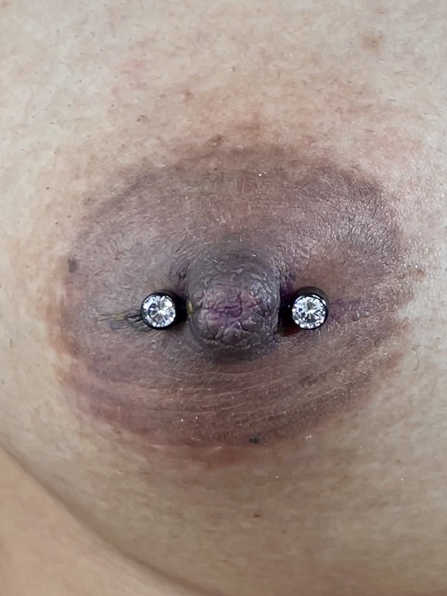 Dulcepiercer's tweet photo. Otro lindos botones de gomita tuneados 😍 Es que miren lo lindo que se ve. Hermoso, precioso y sexy 🔥🔥 Estoy ubicada en Medellín, adornemos tus botones bb 🫶🏻🫶🏻 https://t.co/UJUG9yOzFY