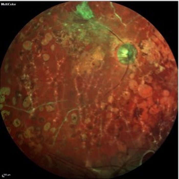 Beyond Vision: EssilorLuxottica’s Bold Moves in 3D Printing and AI-Powered Eyewear fabbaloo.com/news/beyond-vi… #3DPrinting #AdditiveManufacturing