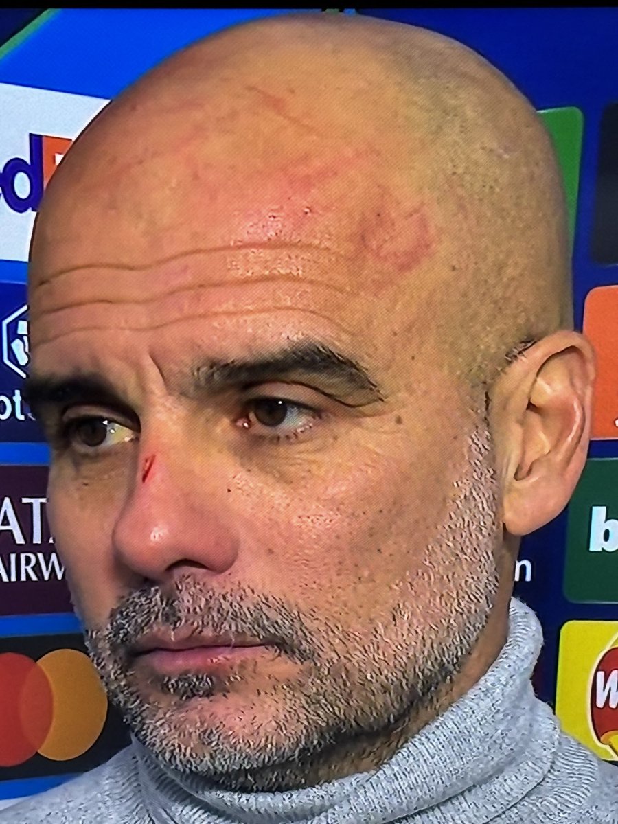 Phil Blundell tweet media