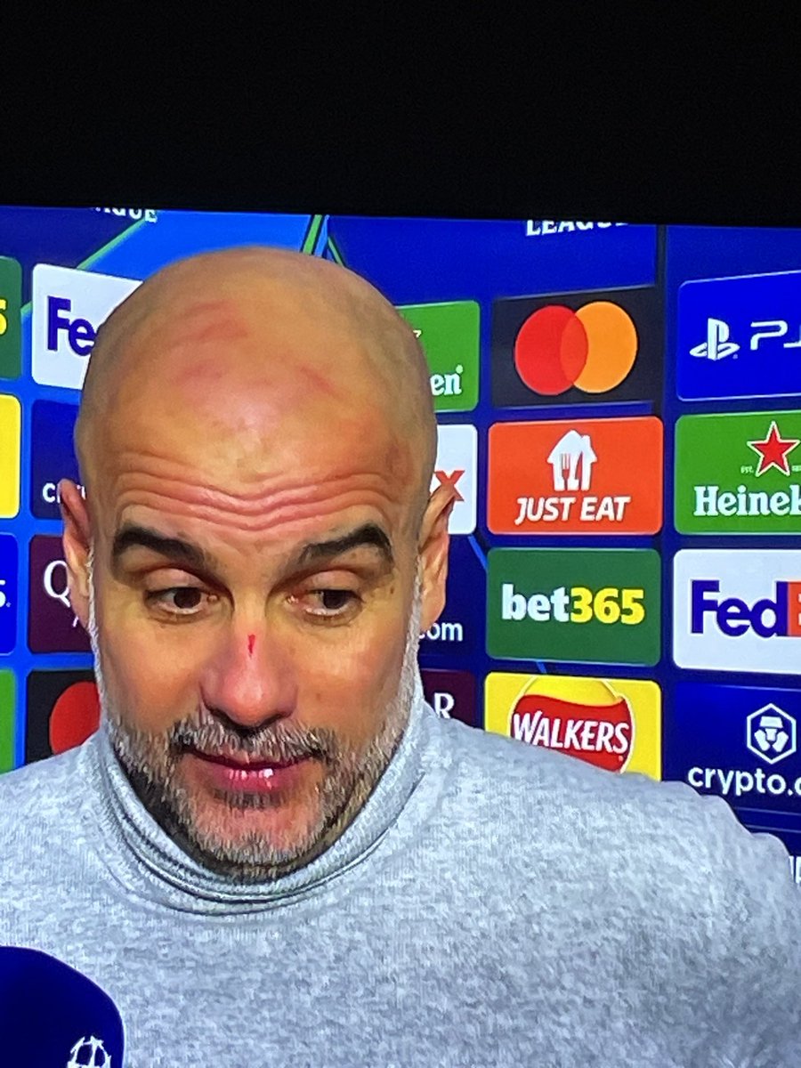 Mikek07's tweet photo. Cut on the nose and red marks all over his head, Pep has definitely sparked out that city team in the dressing room👏🏼🤣🤣🤣 https://t.co/RqswxpSOhQ