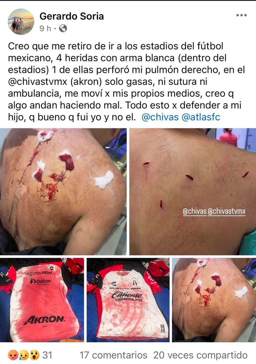 pieldezorrogdl's tweet image. Oigan!  ¿Y va a haber castigo al estadio AKRON por los aficionados que se saltaron a la cancha y el aficionado del @AtlasFC  acuchillado?

¿O se van a hacer pendej0s?

@MikelArriolaP 
@FMF 
@LigaBBVAMX 
@fifacom_es 
@FIFAcom 
@fantasmasuarez 
@ArizpeMiguelZ 
@Chivas 
@TUDNMEX