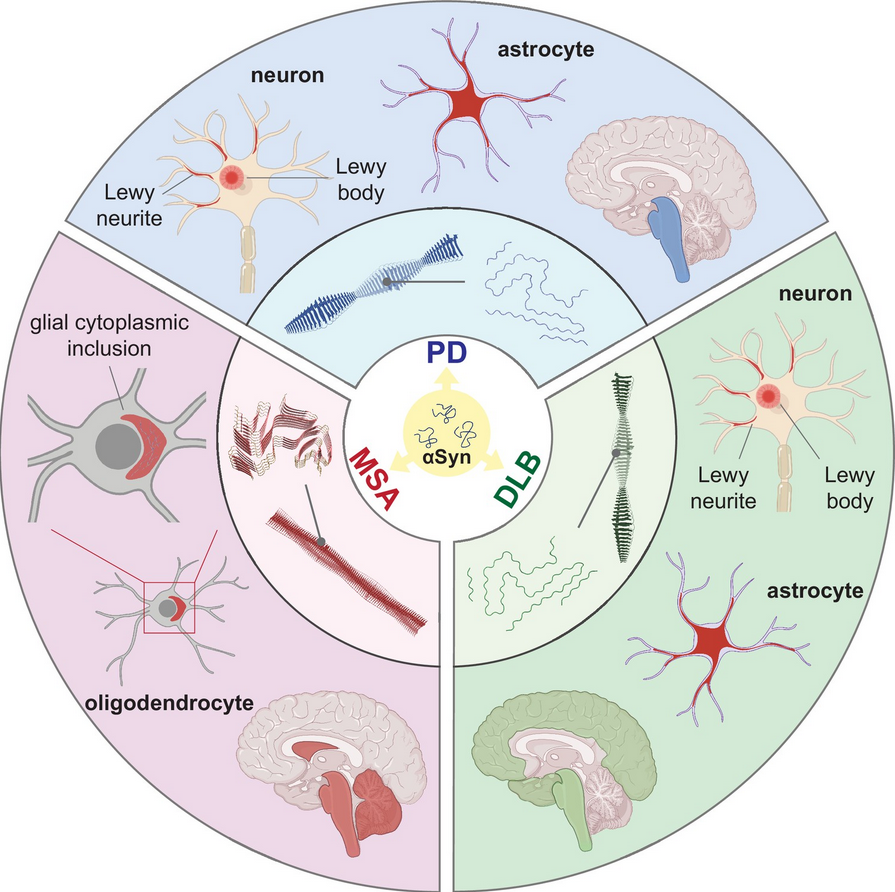 ScienceofPD's tweet photo. New research compares the strain properties of #Parkinsons-associated alpha-synuclein fibrils isolated from Lewy Body Dementia (LDB) &amp; Multiple Systems Atrophy (MSA) patient samples with the resulting amplified fibrils following seeding ampliﬁcation assay
https://t.co/hwT0iwWO6x https://t.co/YuDJrZYXe9