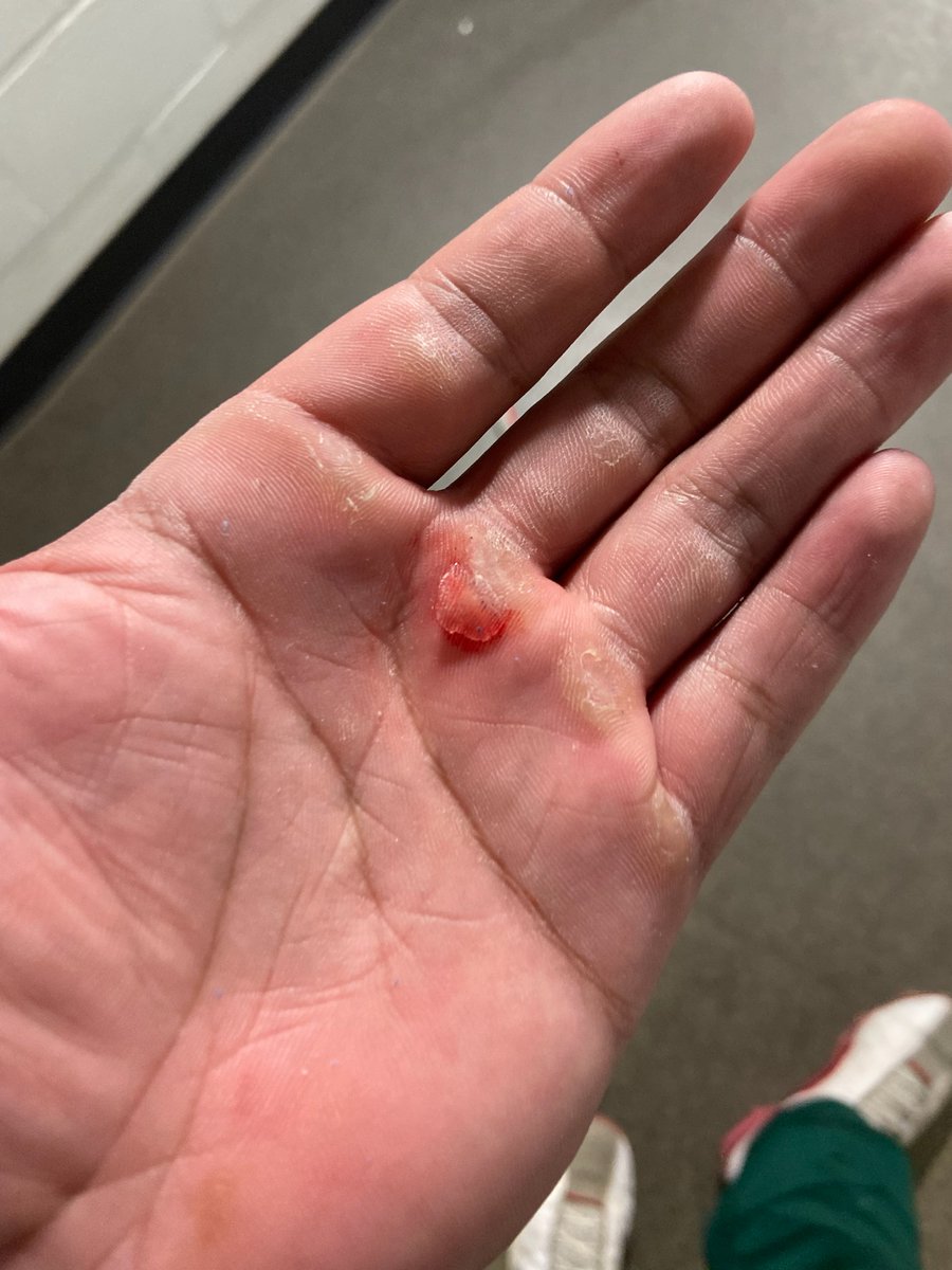 PabloAl30877758's tweet photo. Yahir last night in the HR derby blasted 5 HR with a bleeding Callus with the farthest ball going 416' Your hard work is showing off #MrAverage Mom, and Dad loves you https://t.co/VoemqJGAxp