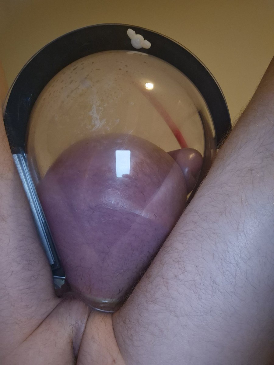 Pumping my salinefilled meat, need to get bigger #salinedballs #monstertube #monstermeat