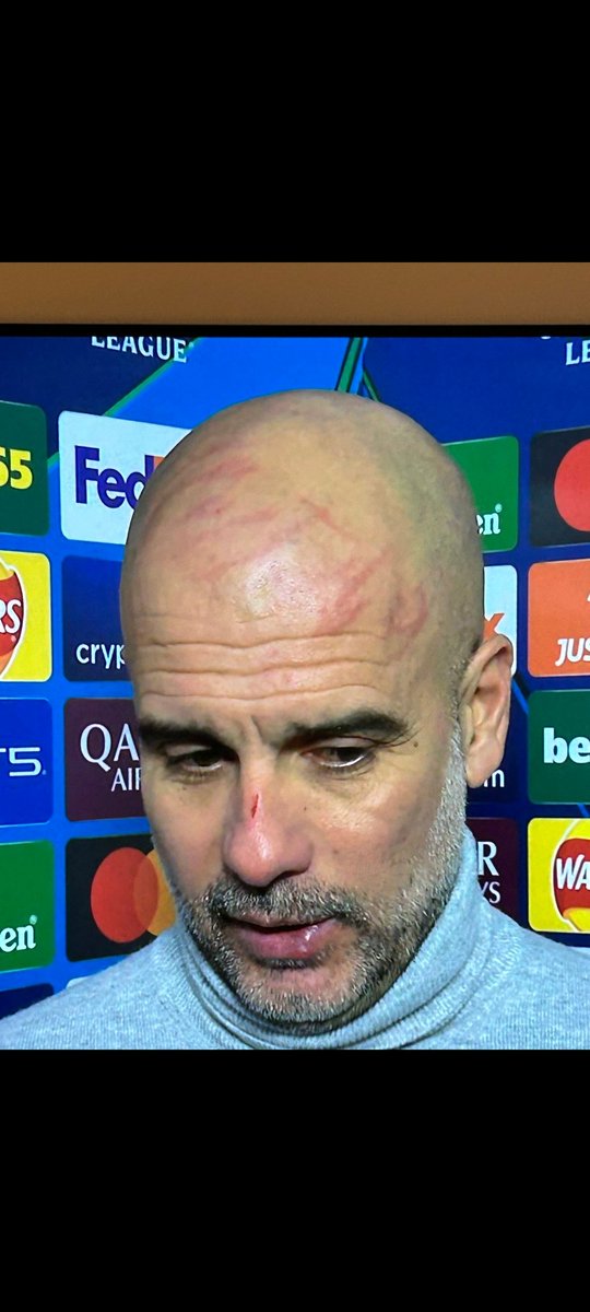 Looks like he was trying to break into Kevin McCallisters' house #pepout #ManCity