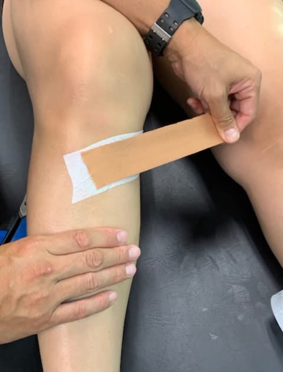 kc_ida's tweet photo. 【足関連鎖®リリース】
患者さんのコメント

圭介は後脛骨筋腱の断裂の際にリハビリを担当してくれました。フレンドリーで知識が豊富で、多種多様なケガの治し方についてとてもよく勉強していて患者を大切にするの治療家です。彼を強く推薦します。
セミナー👇
https://t.co/QLFlBl1liQ @takedaiguji https://t.co/1XbEVyBXBK
