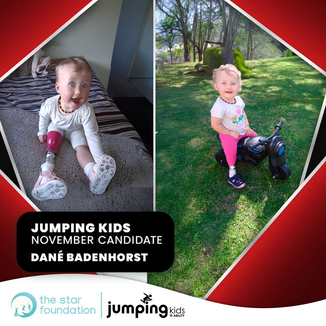 Meet Dane our youngest @JumpingKidsSA beneficiary for November!

At just 1 year old Dane is already thriving with her first prosthetic limb, hitting toddler milestones, and embracing life with confidence. ❤️

Read the inspiring story : bit.ly/4i6fLSk