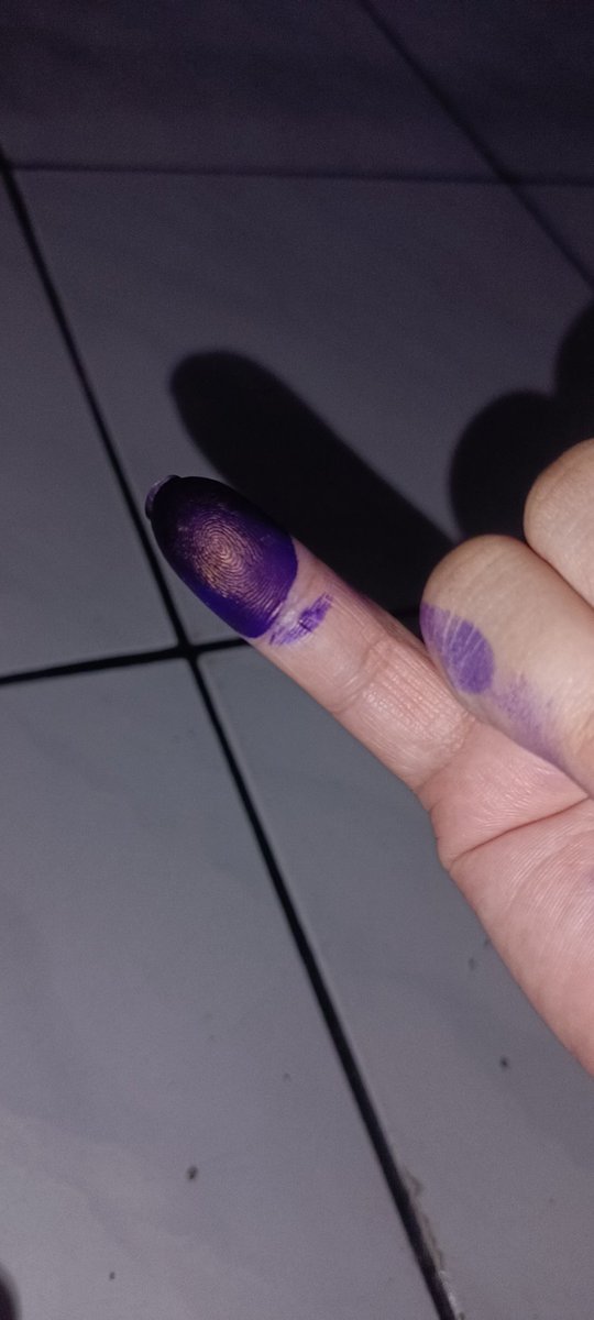 eLQie7's tweet photo. @whitestoryid #Pilkada #Nyoblos #Pilkada2024

seri acne package, aminnn https://t.co/5fABoLTT6p