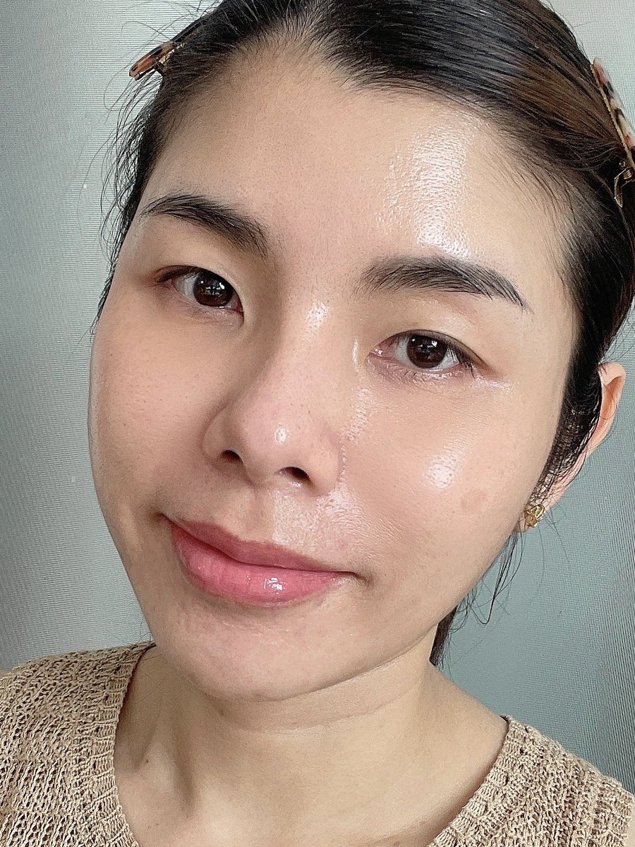อีก 2 ตัวช่วยในรูทีนลดจุดด่างดำ+ปรับผิวใสเร็วคือคู่นี้ SKINTIFIC dark spot & retinol renewal serum รอยสิวจางผิวเกลี้ยงขึ้นในราคาหลักร้อย ผิวเป็นสิวใช้แล้วไม่ดันสิว🫶🏻 ผิวไม่แห้งไม่ระคายเคืองใดๆ เลย อ่อนโยนมาก 

ตัวแรก🌤️🌛เซรั่ม dark spot มีส่วนผสมยับยั้งการสร้างเม็ดสีเมลานินคือSymWhite377 และ Niacinamide ได้เรื่องผิวแข็งแรง & ซ่อมแซมผิวเป็นสิว ช่วยปลอบประโลมพร้อมลดการอักเสบ ถึงว่ารอยสิวจางไวดีขึ้นได้ใน 2 วีค

ใช้คู่🌛เซรั่ม retinol renewal สกัดจากเรตินอลบริสุทธิ์ 0.1% ผลัดผิวอ่อนๆ ให้เรียบเนียน และกระจ่างใส ผิวดูเกลี้ยงขึ้น เป็นเรตินอลที่ช่วยลดการเกิดสิวได้ สำหรับมือใหม่หรือผิวแพ้ง่าย ให้ใช้ 2-3 วัน/สัปดาห์ทาแค่กลางคืนนะคะ อีกทั้งช่วยเรื่องริ้วรอยตื้นๆ ใน1-2 เดือนแรกด้วย ขึ้นอยู่กับสภาพผิวแต่ละบุคคล